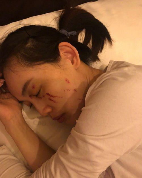 吃瓜被人打伤  第3张